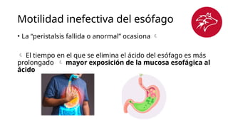 Motilidad inefectiva del esófago
• La “peristalsis fallida o anormal” ocasiona 
 El tiempo en el que se elimina el ácido del esófago es más
prolongado  mayor exposición de la mucosa esofágica al
ácido
 