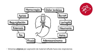  Síntomas atípicos por aspiración de material refluido hacia vías respiratorias
 