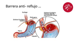 Barrera anti- reflujo …
 