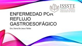 ENFERMEDAD POR
REFLUJO
GASTROESOFÁGICO
Dra. Diana De Jesus Tafolla
 
