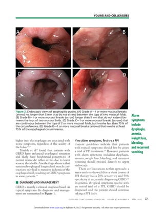 CLEVELAND CLINIC JOURNAL OF MEDICINE VOLUME 87 • NUMBER 4 APRIL 2020 225
YOUNG AND COLLEAGUES
higher into the esophagus are associated with
worse symptoms, regardless of the acidity of
the bolus.12,13
Trimble et al13
found that patients with
GERD have enhanced esophageal sensation
and likely have heightened perceptions of
normal nonacidic reflux events due to lower
sensory thresholds. Another hypothesis is that
sustained esophageal longitudinal muscle con-
tractions may lead to transient ischemia of the
esophageal wall, resulting in GERD symptoms
in some patients.14
■ DIAGNOSIS AND MANAGEMENT
GERD is mainly a clinical diagnosis based on
typical symptoms. Its diagnosis and manage-
ment are summarized in Figure 1.
If no alarm symptoms, ﬁrst try a PPI
Current guidelines indicate that patients
with typical symptoms should first be given
a trial of PPI treatment.15
However, patients
with alarm symptoms including dysphagia,
anemia, weight loss, bleeding, and recurrent
vomiting should proceed directly to upper
endoscopy.
There are limitations to this approach: a
meta-analysis showed that a short course of
PPI therapy has a 78% sensitivity and 54%
specificity in accurately diagnosing GERD.16
In general, if typical symptoms resolve with
an initial trial of a PPI, GERD should be
diagnosed and the patient should continue
taking a PPI daily.
Alarm
symptoms
include
dysphagia,
anemia,
weight loss,
bleeding,
and recurrent
vomiting
Figure 2. Endoscopic views of esophagitis grades. (A) Grade A—1 or more mucosal breaks
(arrow) no longer than 5 mm that do not extend between the tops of two mucosal folds.
(B) Grade B—1 or more mucosal breaks (arrow) longer than 5 mm that do not extend be-
tween the tops of two mucosal folds. (C) Grade C—1 or more mucosal breaks (arrows) that
are continuous between the tops of 2 or more mucosal folds, but involve less than 75% of
the circumference. (D) Grade D—1 or more mucosal breaks (arrows) that involve at least
75% of the esophageal circumference.
on February 8, 2022. For personal use only. All other uses require permission.
www.ccjm.org
Downloaded from
 