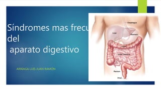 Síndromes mas frecuentes
del
aparato digestivo
ARRIAGA LUIS JUAN RAMÓN
 
