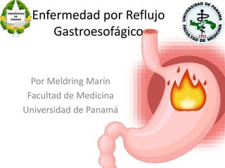 Enfermedad por Reflujo
Gastroesofágico
Por Meldring Marín
Facultad de Medicina
Universidad de Panamá
 