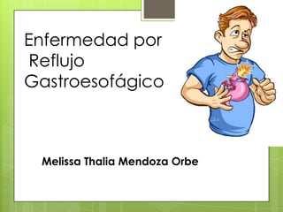 Enfermedad por
Reflujo
Gastroesofágico
Melissa Thalia Mendoza Orbe
 
