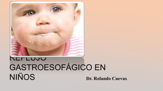 REFLUJO
GASTROESOFÁGICO EN
NIÑOS Dr. Rolando Cuevas.
 