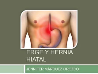 ERGE Y HERNIA
HIATAL
JENNIFER MÁRQUEZ OROZCO
 