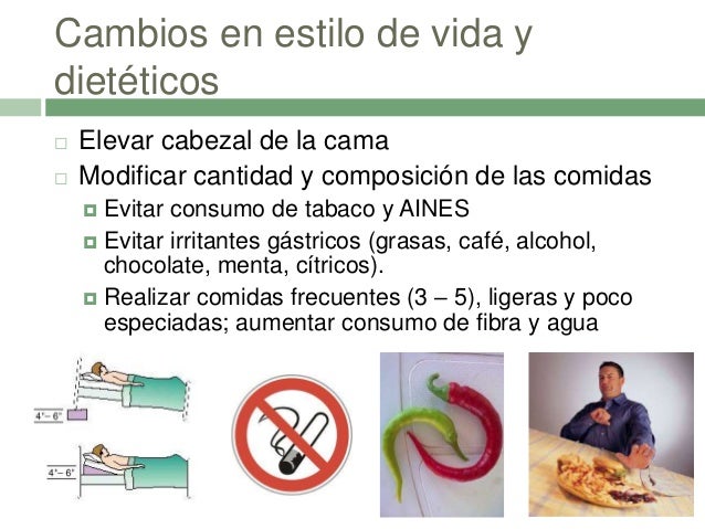 Erge y hernia hiatal Erge y hernia hiatal