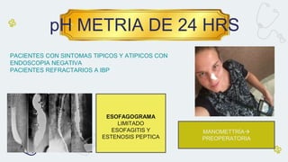 pH METRIA DE 24 HRS
PACIENTES CON SINTOMAS TIPICOS Y ATIPICOS CON
ENDOSCOPIA NEGATIVA
PACIENTES REFRACTARIOS A IBP
ESOFAGOGRAMA
LIMITADO
ESOFAGITIS Y
ESTENOSIS PEPTICA
MANOMETTRÍA
PREOPERATORIA
 