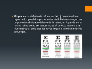  Miopía: es un defecto de refracción del ojo en el cual los
rayos de luz paralelos procedentes del infinito convergen en
un punto focal situado delante de la retina, en lugar de en la
misma retina como sería normal; es el defecto inverso a la
hipermetropía, en la que los rayos llegan a la retina antes de
converger.
 