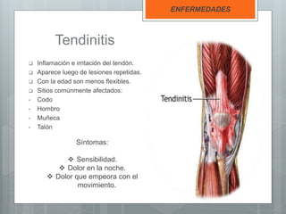 Tendinitis
 Inflamación e irritación del tendón.
 Aparece luego de lesiones repetidas.
 Con la edad son menos flexibles.
 Sitios comúnmente afectados:
• Codo
• Hombro
• Muñeca
• Talón
ENFERMEDADES
Síntomas:
 Sensibilidad.
 Dolor en la noche.
 Dolor que empeora con el
movimiento.
 