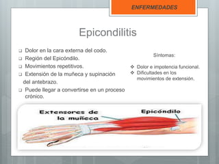 Epicondilitis
 Dolor en la cara externa del codo.
 Región del Epicóndilo.
 Movimientos repetitivos.
 Extensión de la muñeca y supinación
del antebrazo.
 Puede llegar a convertirse en un proceso
crónico.
ENFERMEDADES
Síntomas:
 Dolor e impotencia funcional.
 Dificultades en los
movimientos de extensión.
 