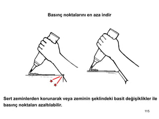 Sert zeminlerden korunarak veya zeminin şeklindeki basit değişiklikler ile
basınç noktaları azaltılabilir.
Basınç noktalarını en aza indir
115
 