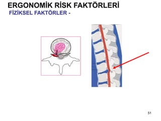 51
ERGONOMİK RİSK FAKTÖRLERİ
FİZİKSEL FAKTÖRLER - Diskler
 