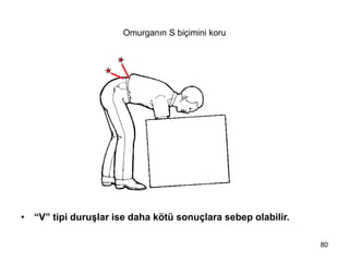 Omurganın S biçimini koru
• “V” tipi duruşlar ise daha kötü sonuçlara sebep olabilir.
80
 
