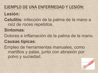 Ejemplo de una enfermedad y lesión:	Lesión:Celulitis: infección de la palma de la mano a raíz de roces repetidos.Síntomas:Dolores e inflamación de la palma de la mano.Causas típicas:Empleo de herramientas manuales, como martillos y palas, junto con abrasión por polvo y suciedad.