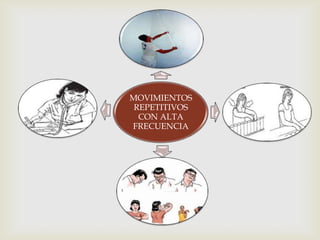 MOVIMIENTOS
 REPETITIVOS
  CON ALTA
FRECUENCIA
 