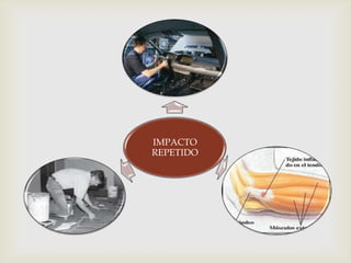 IMPACTO
REPETIDO
 