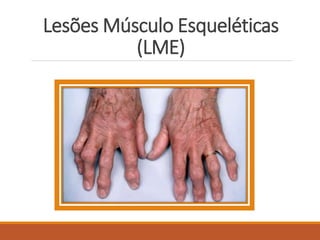 Lesões Músculo Esqueléticas
(LME)
 