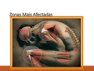 Zonas Mais Afectadas
 