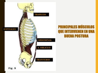 PRINCIPALES MÚSCULOS
QUE INTERVIENEN EN UNA
BUENA POSTURA
TRAPECIO
ABDOMINAL
A. OBLICUO
TRANVERSO
ESPINALES
 