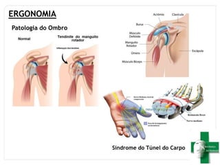 ERGONOMIA
Patologia do Ombro
Síndrome do Túnel do Carpo
 