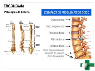 ERGONOMIA
Patologias da Coluna
 
