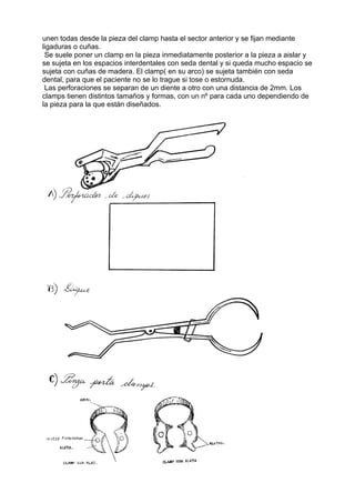 unen todas desde la pieza del clamp hasta el sector anterior y se fijan mediante
ligaduras o cuñas.
 Se suele poner un clamp en la pieza inmediatamente posterior a la pieza a aislar y
se sujeta en los espacios interdentales con seda dental y si queda mucho espacio se
sujeta con cuñas de madera. El clamp( en su arco) se sujeta también con seda
dental, para que el paciente no se lo trague si tose o estornuda.
 Las perforaciones se separan de un diente a otro con una distancia de 2mm. Los
clamps tienen distintos tamaños y formas, con un nº para cada uno dependiendo de
la pieza para la que están diseñados.
 