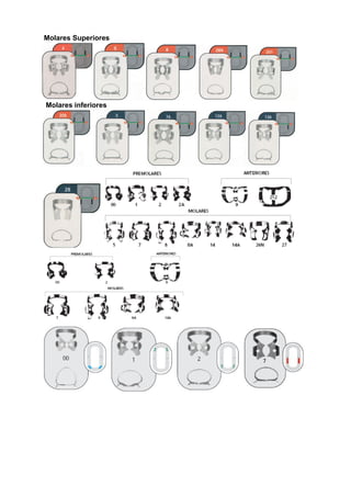Molares Superiores




Molares inferiores
 