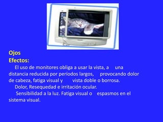 Ojos
Efectos:
El uso de monitores obliga a usar la vista, a una
distancia reducida por períodos largos, provocando dolor
de cabeza, fatiga visual y vista doble o borrosa.
Dolor, Resequedad e irritación ocular.
Sensibilidad a la luz. Fatiga visual o espasmos en el
sistema visual.
 