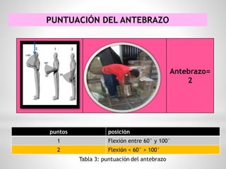 PUNTUACIÓN DEL ANTEBRAZO
puntos posición
1 Flexión entre 60° y 100°
2 Flexión < 60° > 100°
°
Antebrazo=
2
 