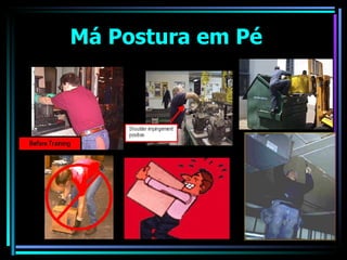 Má Postura em Pé 