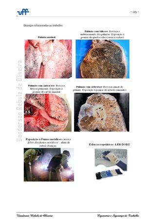- 125 -
-
Uanderson Rebula de Oliveira Ergonomia e Segurança do Trabalho
Doenças relacionadas ao trabalho:
 