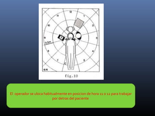 El operador se ubica habitualmente en posicion de hora 11 o 12 para trabajar
por detras del paciente

 