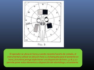 El operador se ubica en hora 9 cuando necesita hacerlo de costado, el
instrumental a utilizar se ubica en hora 1 y la banqueta para el asistente en
hora 3 la turbina jeringa triple tienen una disposición de hora 4 y 8; 5 y 7
permite poner estos elementos a disposición del odontólogo y el asistente.

 