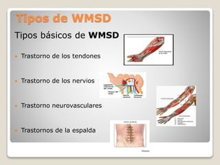 Tipos de WMSD
Tipos básicos de WMSD
 Trastorno de los tendones
 Trastorno de los nervios
 Trastorno neurovasculares
 T...