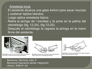 2. Anestesia local.
El asistente alcanza una gasa 4x4cm para secar mucosa
y sostener tejidos blandos.
Luego aplica anestesia tópica.
Retira la jeringa de l bandeja y la pone en la palma del
odontólogo (fig. 12-24), (fig.12-25).
Después el odontólogo la regresa la jeringa en la mano
firme del asistente.
Barrancos Mononey Julio, P.
Barrancos“Operatoria dental: integración
clínica”, 2006.4ª. Ed.
 
