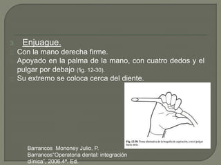 3. Enjuague.
Con la mano derecha firme.
Apoyado en la palma de la mano, con cuatro dedos y el
pulgar por debajo (fig. 12-30).
Su extremo se coloca cerca del diente.
Barrancos Mononey Julio, P.
Barrancos“Operatoria dental: integración
clínica”, 2006.4ª. Ed.
 