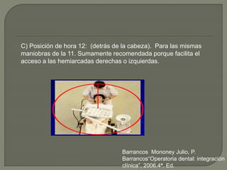 C) Posición de hora 12: (detrás de la cabeza). Para las mismas
maniobras de la 11. Sumamente recomendada porque facilita el
acceso a las hemiarcadas derechas o izquierdas.
Barrancos Mononey Julio, P.
Barrancos“Operatoria dental: integración
clínica”, 2006.4ª. Ed.
 