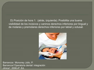 D) Posición de hora 1: (atrás, izquierda). Posibilita una buena
visibilidad de los incisivos y caninos derechos inferiores por lingual y
de molares y premolares derechos inferiores por labial y oclusal.
Barrancos Mononey Julio, P.
Barrancos“Operatoria dental: integración
clínica”, 2006.4ª. Ed.
 