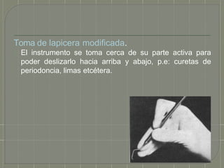 Toma de lapicera modificada.
El instrumento se toma cerca de su parte activa para
poder deslizarlo hacia arriba y abajo, p.e: curetas de
periodoncia, limas etcétera.
 