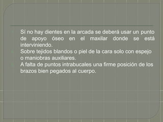 7. Sí no hay dientes en la arcada se deberá usar un punto
de apoyo óseo en el maxilar donde se está
interviniendo.
8. Sobre tejidos blandos o piel de la cara solo con espejo
o maniobras auxiliares.
9. A falta de puntos intrabucales una firme posición de los
brazos bien pegados al cuerpo.
 