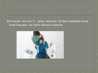 B) Posición de hora 11: (atrás, derecha). Se tiene visibilidad de las
caras linguales por visión directa e indirecta .
 