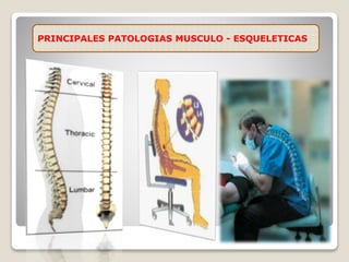 PRINCIPALES PATOLOGIAS MUSCULO - ESQUELETICAS
 