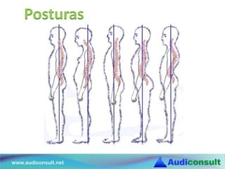 Posturas
 