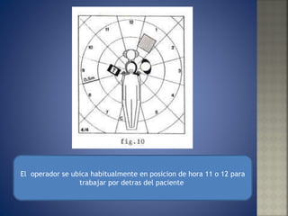 El  operador se ubica habitualmente en posicion de hora 11 o 12 para trabajar por detras del paciente  