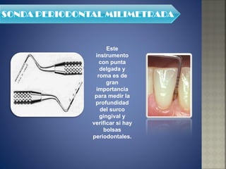 Este instrumento con punta delgada y roma es de gran importancia para medir la profundidad del surco gingival y verificar si hay bolsas periodontales. 