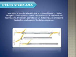 La amalgama es colocada dentro de la preparación con un porta-amalgama, un instrumento con un cilindro hueco que se rellena con la amalgama. Un émbolo operado con un dedo empuja la amalgama hacia afuera del cargador hasta la preparación. 