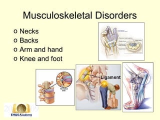 Musculoskeletal Disorders
o Necks
o Backs
o Arm and hand
o Knee and foot
 
