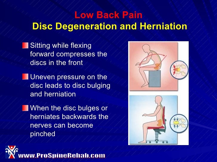 Ergonomics For Dental Hygienists