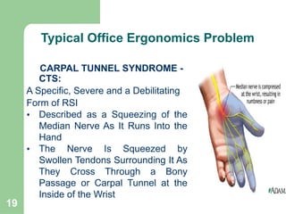 19
CARPAL TUNNEL SYNDROME -
CTS:
A Specific, Severe and a Debilitating
Form of RSI
• Described as a Squeezing of the
Median Nerve As It Runs Into the
Hand
• The Nerve Is Squeezed by
Swollen Tendons Surrounding It As
They Cross Through a Bony
Passage or Carpal Tunnel at the
Inside of the Wrist
Continued
Typical Office Ergonomics Problem
 